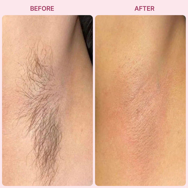 Painless Hair Remover