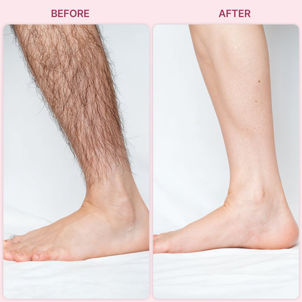 Painless Hair Remover