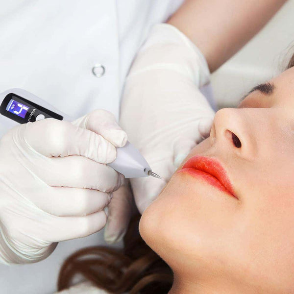 Laser Plasma Pen Skin Tag Remover – 9‑Level Precision