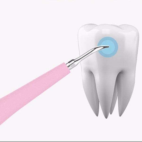 Dental Tartar Removal
