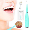 Dental Tartar Removal | Dental cleaning